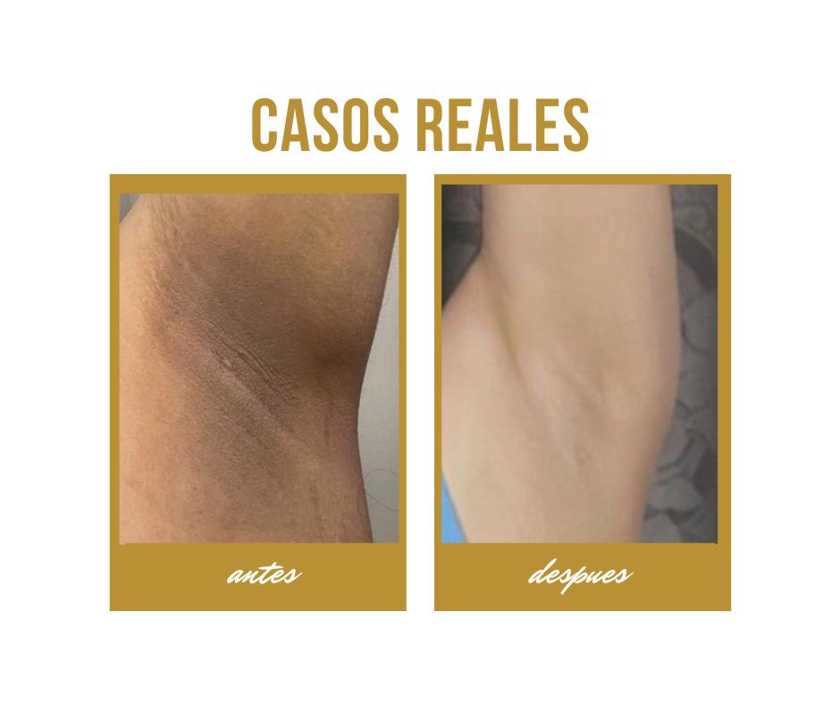 Intimate Brightening Cream