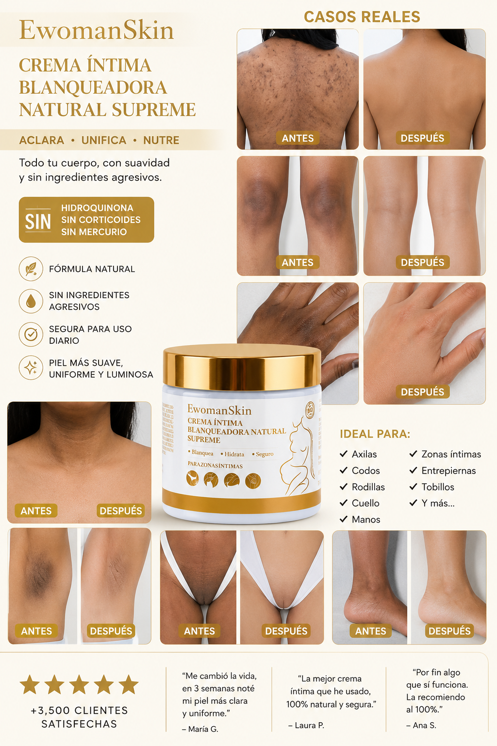 Crema Blanqueadora Antimanchas Intensiva – Para Manchas Fuertes en 30 Días