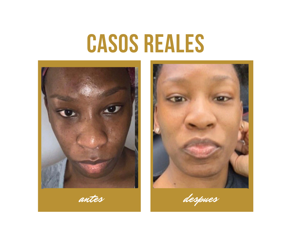 Crema Facial Aclarante y Rejuvenecedora – Piel Uniforme y Juvenil