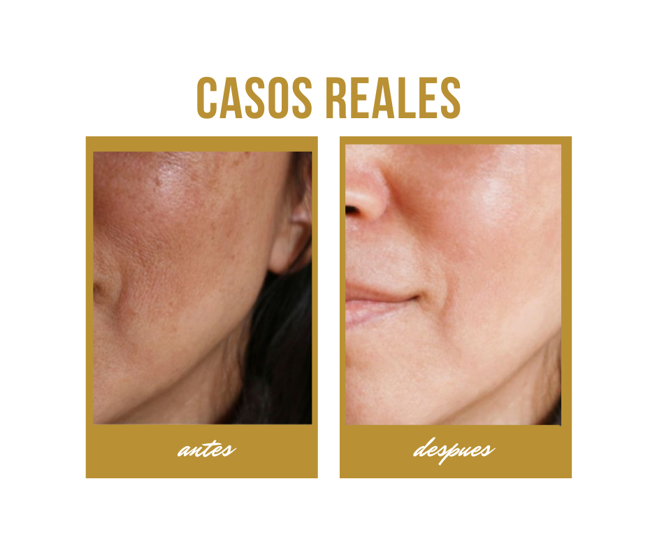 Serum Aclarante natural